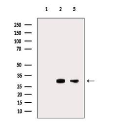 Invitrogen HLA-DMA Polyclonal Antibody 100 &mu;L; Unconjugated:Antibodies,