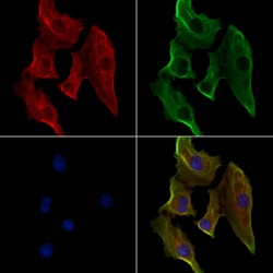 Invitrogen HLA-DMB Polyclonal Antibody 100 &mu;L; Unconjugated:Antibodies,