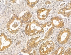 Invitrogen HLA-DQB2 Polyclonal Antibody 100 &mu;L; Unconjugated:Antibodies,