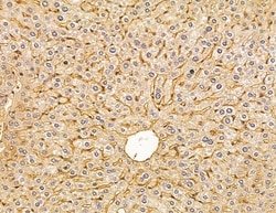 Invitrogen HLA-DQB2 Polyclonal Antibody 100 &mu;L; Unconjugated:Antibodies,