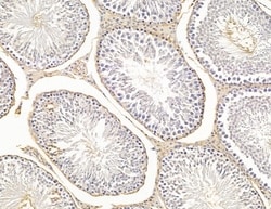 Invitrogen HLA-DQB2 Polyclonal Antibody 100 &mu;L; Unconjugated:Antibodies,