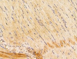 Invitrogen HLA-DQB2 Polyclonal Antibody 100 &mu;L; Unconjugated:Antibodies,