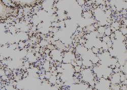 HOXB1 Polyclonal Antibody:Antibodies, Polyclonal