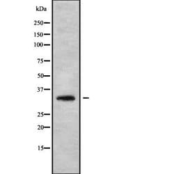 HOXB1 Polyclonal Antibody:Antibodies, Polyclonal