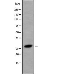 Invitrogen HOXB8 Polyclonal Antibody 100 &mu;L; Unconjugated:Antibodies,