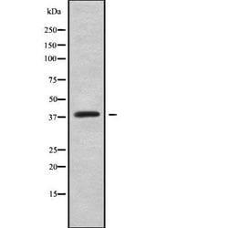 Invitrogen HOXC10 Polyclonal Antibody 100 &mu;L; Unconjugated:Antibodies,