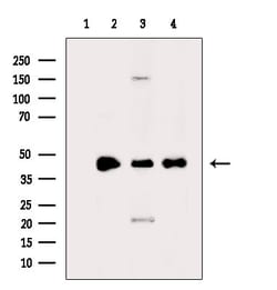 Invitrogen HOXD11 Polyclonal Antibody 100 &mu;L; Unconjugated:Antibodies,