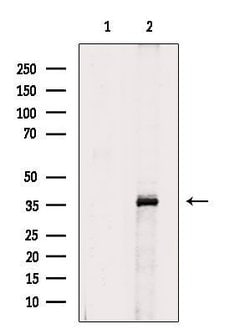 Invitrogen HOXD13 Polyclonal Antibody 100 &mu;L; Unconjugated:Antibodies,