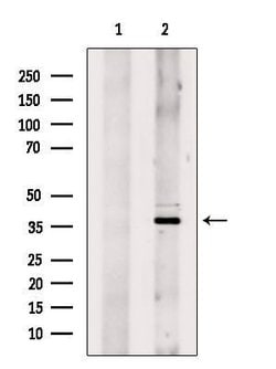 Invitrogen HOXD9 Polyclonal Antibody 100 &mu;L; Unconjugated:Antibodies,