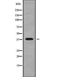Invitrogen Nkx2.3 Polyclonal Antibody 100 &mu;L; Unconjugated:Antibodies,