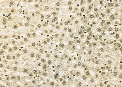 Invitrogen NKX6-2 Polyclonal Antibody 100 &mu;L | Buy Online | Invitrogen&trade; | Fisher Scientific