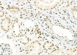 Invitrogen NKX6-2 Polyclonal Antibody 100 &mu;L | Buy Online | Invitrogen&trade; | Fisher Scientific