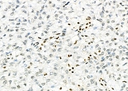 Invitrogen NKX6-2 Polyclonal Antibody 100 &mu;L | Buy Online | Invitrogen&trade; | Fisher Scientific