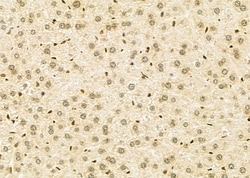 Invitrogen NKX6-2 Polyclonal Antibody 100 &mu;L | Buy Online | Invitrogen&trade; | Fisher Scientific