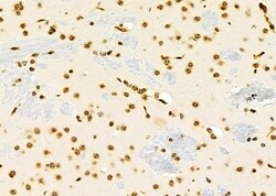 Invitrogen NKX6-2 Polyclonal Antibody 100 &mu;L | Buy Online | Invitrogen&trade; | Fisher Scientific