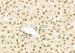 Invitrogen NKX6-2 Polyclonal Antibody 100 &mu;L | Buy Online | Invitrogen&trade; | Fisher Scientific