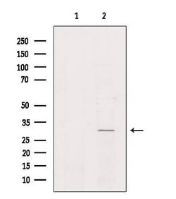 Invitrogen NKX6-2 Polyclonal Antibody 100 &mu;L | Buy Online | Invitrogen&trade; | Fisher Scientific