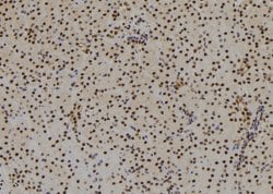 Invitrogen SIX3 Polyclonal Antibody 100 &mu;L; Unconjugated:Antibodies,