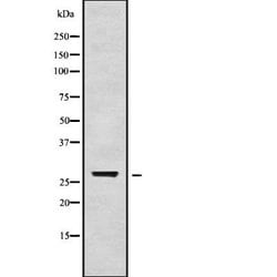 Invitrogen TGIF2LX Polyclonal Antibody 100 &mu;L; Unconjugated:Antibodies,