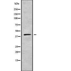 Kir7.1 (KCNJ13) Polyclonal Antibody:Antibodies, Polyclonal