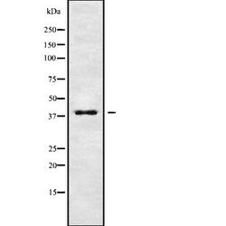 KIR2DL2 Polyclonal Antibody:Antibodies, Polyclonal