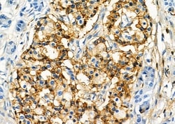 Invitrogen KIR2DL5A Polyclonal Antibody 100 &mu;L; Unconjugated:Antibodies,