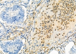 Invitrogen KIR2DL5A Polyclonal Antibody 100 &mu;L; Unconjugated:Antibodies,