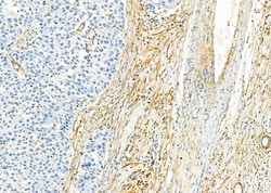 Invitrogen KIR2DL5A Polyclonal Antibody 100 &mu;L; Unconjugated:Antibodies,