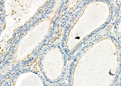 Invitrogen KIR2DL5A Polyclonal Antibody 100 &mu;L; Unconjugated:Antibodies,