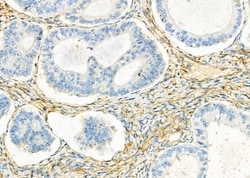 Invitrogen KIR2DL5A Polyclonal Antibody 100 &mu;L; Unconjugated:Antibodies,