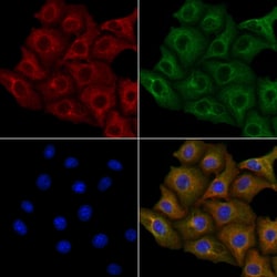 Invitrogen KIR2DS5 Polyclonal Antibody 100 &mu;L; Unconjugated:Antibodies,