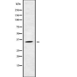 Invitrogen KIR2DS5 Polyclonal Antibody 100 &mu;L; Unconjugated:Antibodies,