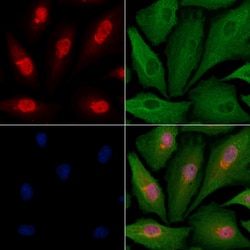 Invitrogen MED11 Polyclonal Antibody 100 &mu;L; Unconjugated:Antibodies,