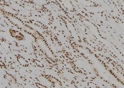 Invitrogen MED22 Polyclonal Antibody 100 &mu;L; Unconjugated:Antibodies,