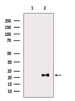 Invitrogen MED22 Polyclonal Antibody 100 &mu;L; Unconjugated:Antibodies,