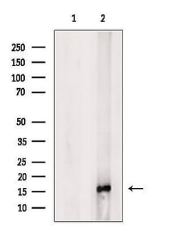 Invitrogen MED9 Polyclonal Antibody 100 &mu;L | Buy Online | Invitrogen&trade; | Fisher Scientific