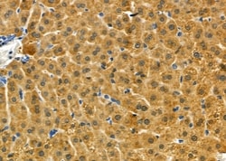 Invitrogen IMMP2L Polyclonal Antibody 100 &mu;L | Buy Online | Invitrogen&trade; | Fisher Scientific