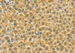 Invitrogen IMMP2L Polyclonal Antibody 100 &mu;L | Buy Online | Invitrogen&trade; | Fisher Scientific