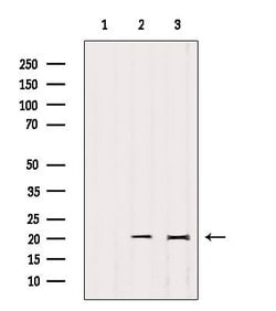 Invitrogen IMMP2L Polyclonal Antibody 100 &mu;L | Buy Online | Invitrogen&trade; | Fisher Scientific