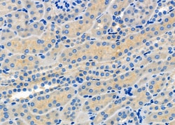 Invitrogen MCT5 Polyclonal Antibody 100 &mu;L | Buy Online | Invitrogen&trade; | Fisher Scientific