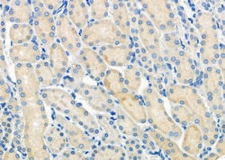 Invitrogen MCT5 Polyclonal Antibody 100 &mu;L | Buy Online | Invitrogen&trade; | Fisher Scientific