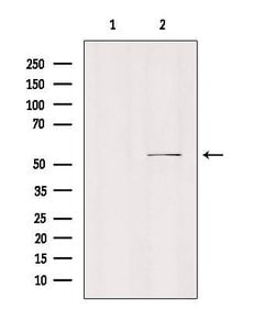 Invitrogen MCT5 Polyclonal Antibody 100 &mu;L | Buy Online | Invitrogen&trade; | Fisher Scientific
