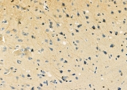 Invitrogen SLC16A6 Polyclonal Antibody 100 &mu;L; Unconjugated:Antibodies,