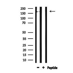 Invitrogen ABCC6 Polyclonal Antibody 100 &mu;L | Buy Online | Invitrogen&trade; | Fisher Scientific
