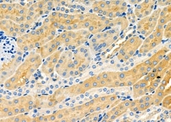 Invitrogen ABCC6 Polyclonal Antibody 100 &mu;L | Buy Online | Invitrogen&trade; | Fisher Scientific