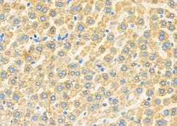 Invitrogen ABCC6 Polyclonal Antibody 100 &mu;L | Buy Online | Invitrogen&trade; | Fisher Scientific