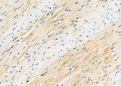 Invitrogen MEGF6 Polyclonal Antibody 100 &mu;L; Unconjugated:Antibodies,