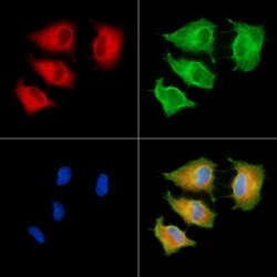 Invitrogen MYO3B Polyclonal Antibody 100 &mu;L; Unconjugated:Antibodies,