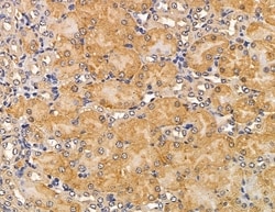 Invitrogen MYO3B Polyclonal Antibody 100 &mu;L; Unconjugated:Antibodies,