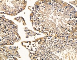Invitrogen MYO3B Polyclonal Antibody 100 &mu;L; Unconjugated:Antibodies,